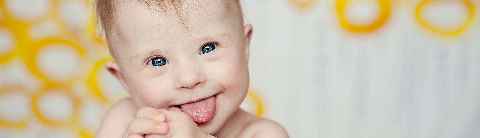 A smiling baby with Down syndrome